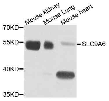 Polyclonal Rabbit anti-Human SLC9A6 Antibody (WB)