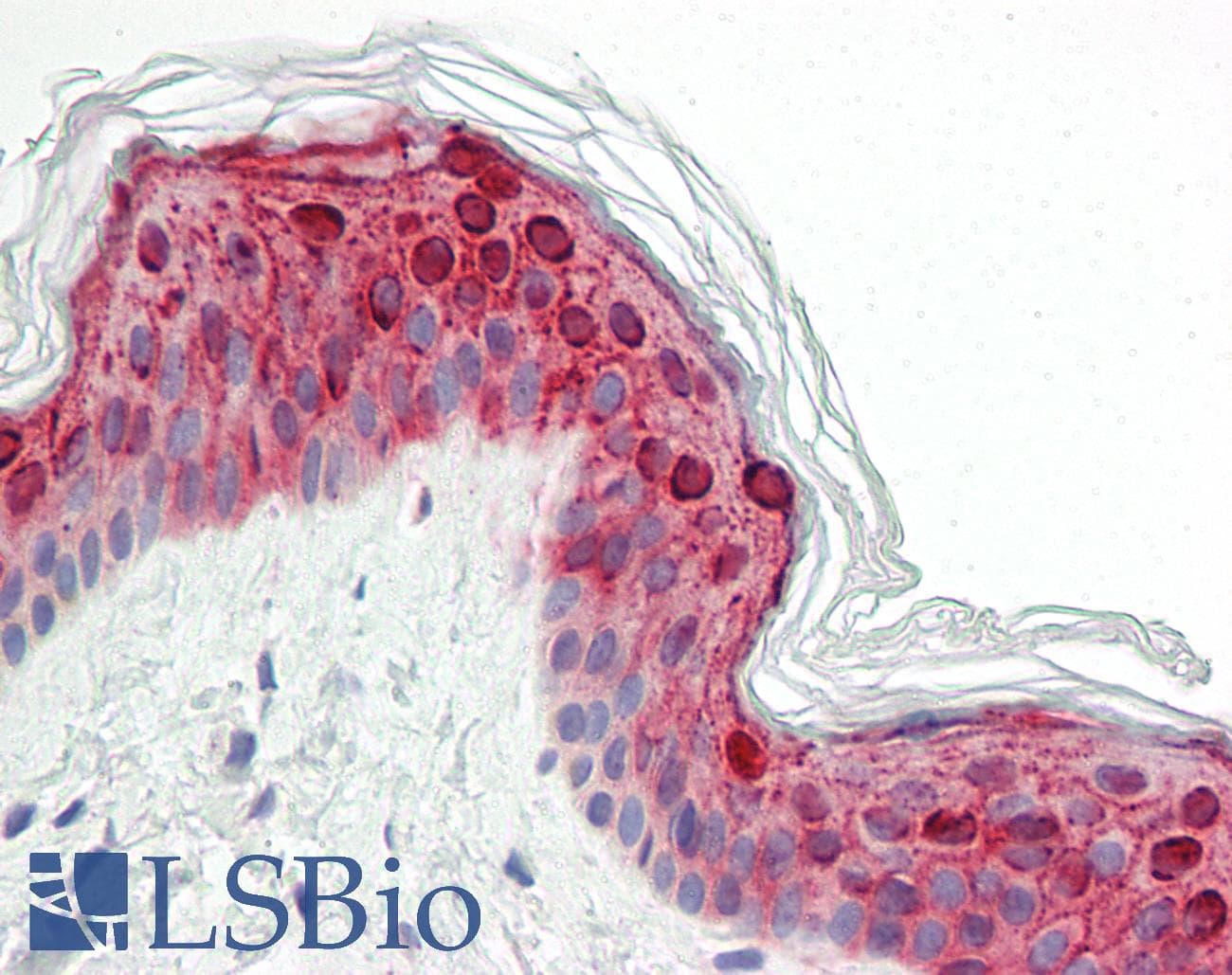 IHC-plus™ ZDHHC9 Antibody (aa315-364)