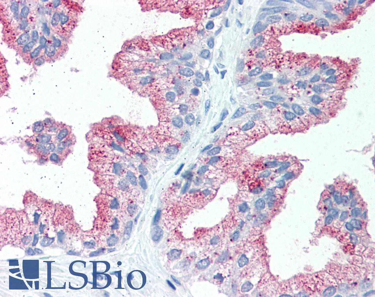 IHC-plus™ SLC39A14 / ZIP14 Antibody (Internal)