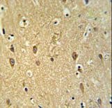 GPR17 Antibody (aa230-258)