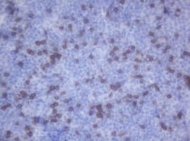 Monoclonal Mouse anti-Human CD2 Antibody (clone OTI1C5, IHC, WB)