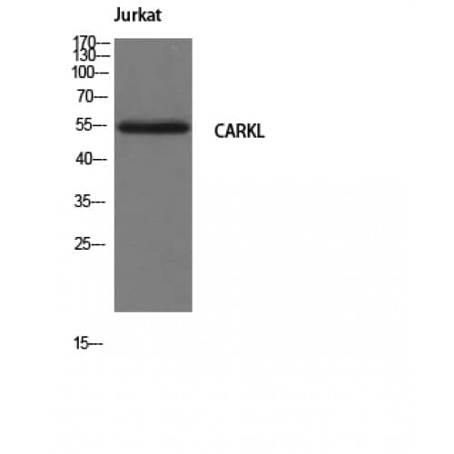 SHPK / CARKL Antibody (1-80 aa, N-terminal)