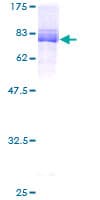 Human MLLT6 Protein (Recombinant GST)