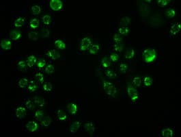 AK1 / Adenylate Kinase 1 Antibody (clone OTI5G8)