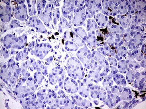 S100A9 / MRP14 Antibody (clone UMAB173)