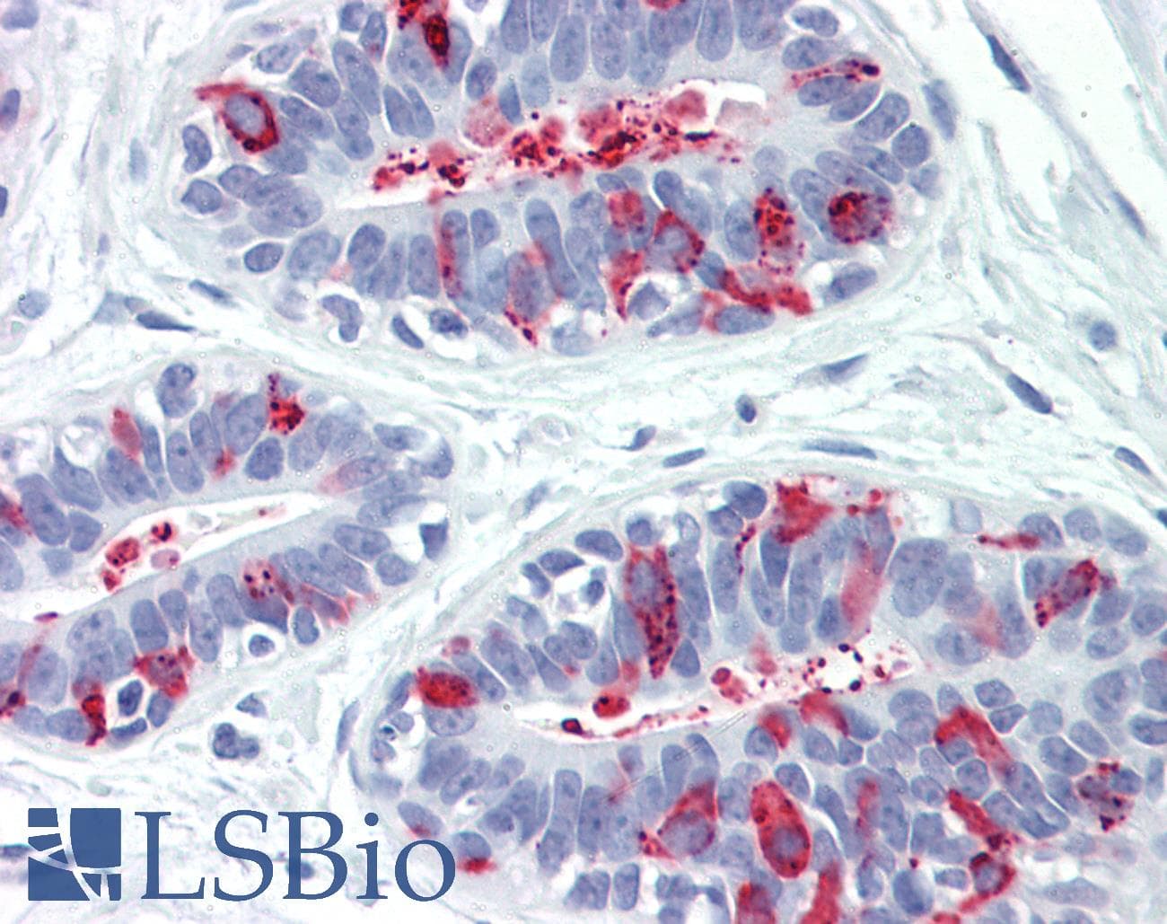 IHC-plus™ Monoclonal Mouse anti-Human CTSC / Cathepsin C / JP Antibody (IHC, WB)
