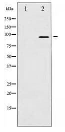 NBN / Nibrin Antibody