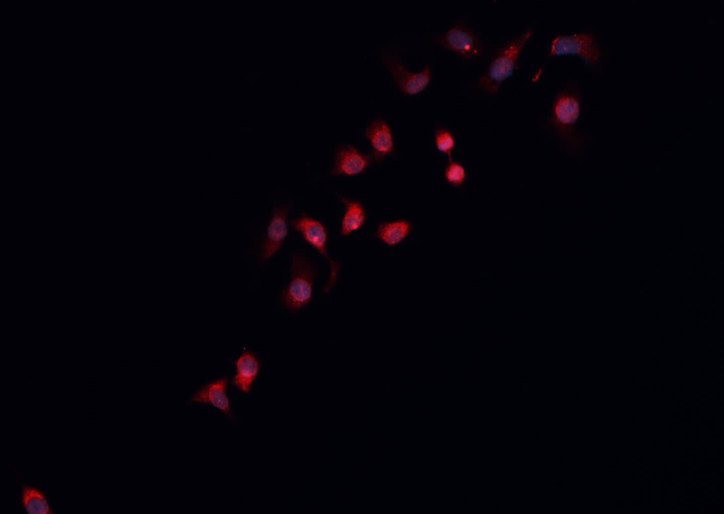TSAP6 / STEAP3 Antibody (aa26-53)