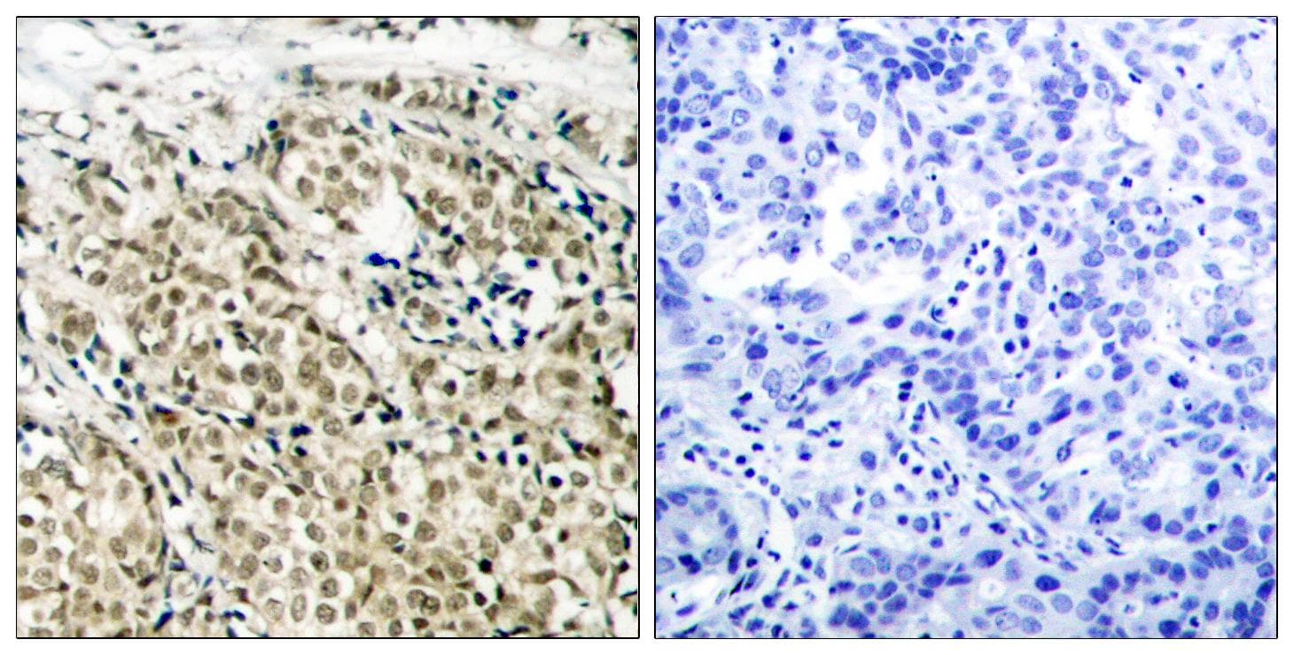 AR / Androgen Receptor Antibody (p213)