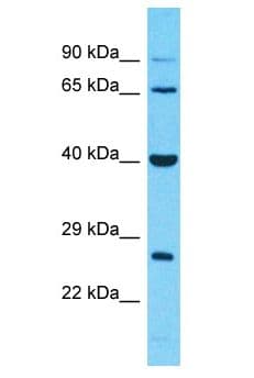 Polyclonal Rabbit anti-Human IGSF4C / CADM4 Antibody (aa156-205, WB)