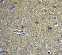 PRKCA / PKC-Alpha Antibody (phospho-Thr638, clone E195)