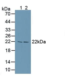 PSMB8 / LMP7 Antibody (aa75-261)