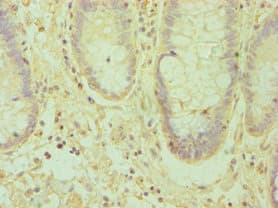 Polyclonal Rabbit anti-Human EFNA1 / Ephrin A1 Antibody (aa19-182, IHC)