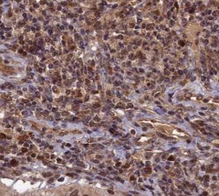 TOP1 / Topoisomerase I Antibody