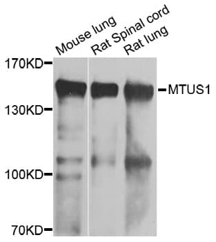 MTUS1 Antibody