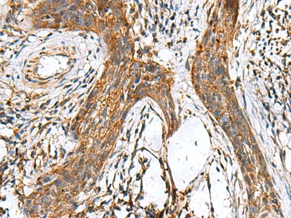 Polyclonal Rabbit anti-Human TTR / Transthyretin Antibody (IHC, WB)