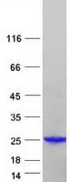 Human ARL2 Protein (Recombinant Myc-DDK (Flag))