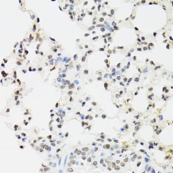 EDF1 / MBF1 Antibody