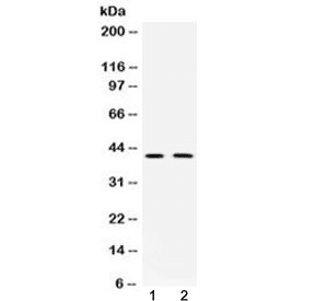 DCX / Doublecortin Antibody