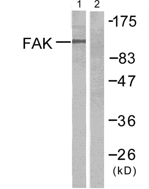 FAK / Focal Adhesion Kinase Antibody (p397)
