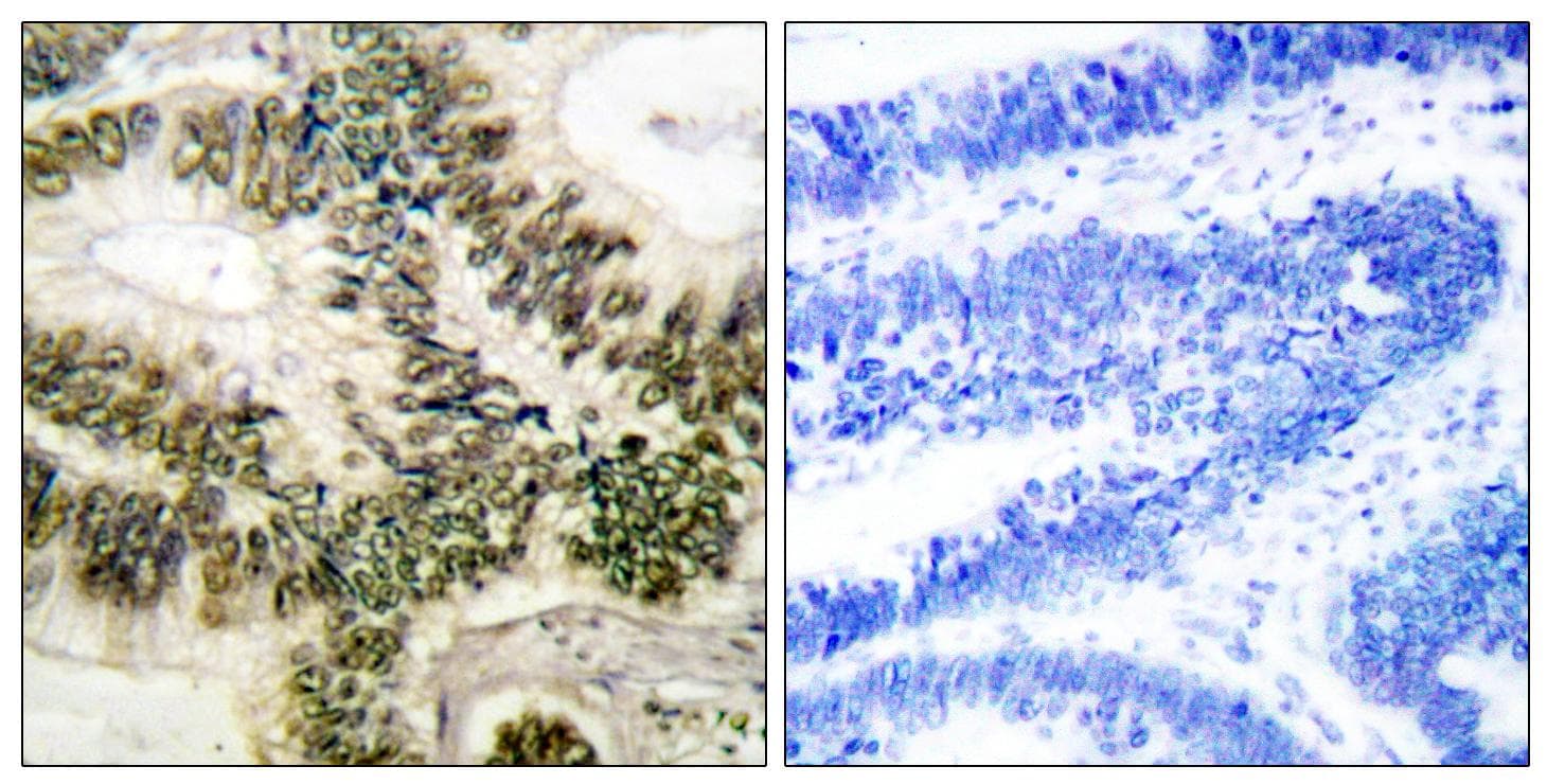 CCNE1 / Cyclin E1 Antibody (p395)