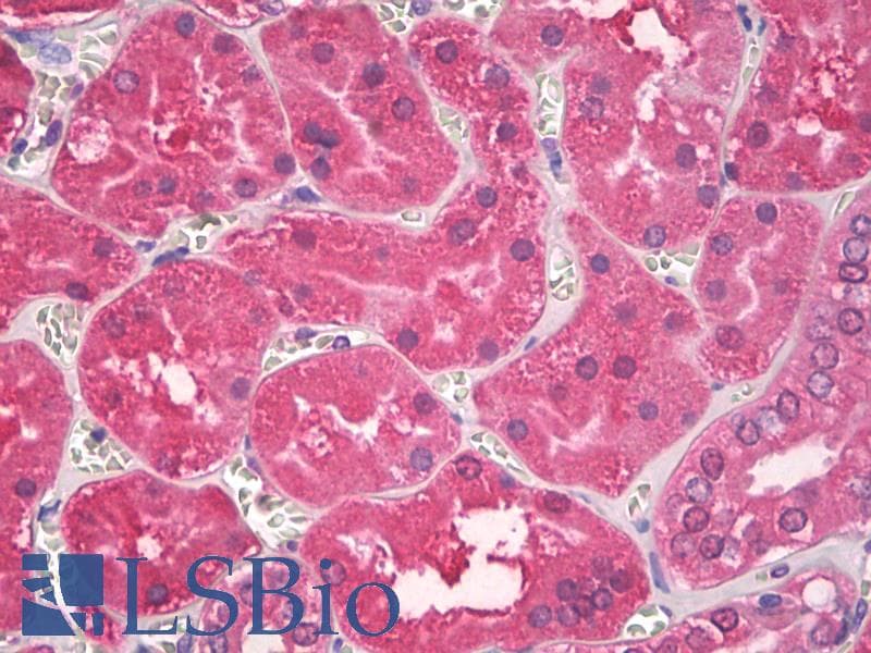 IHC-plus™ Superoxide Dismutase Antibody