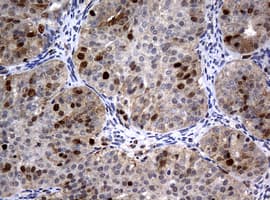 PCNA Antibody (clone OTI6B6)