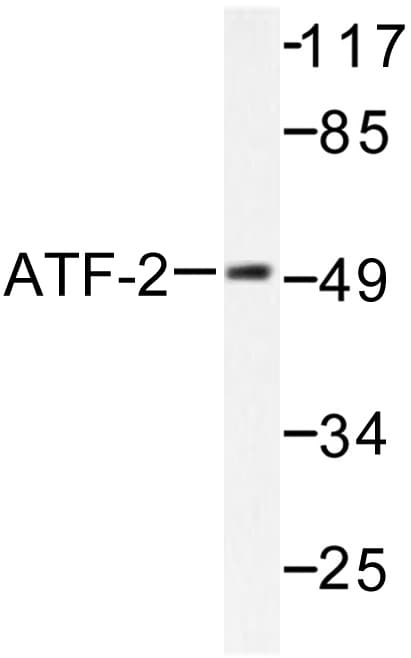 ATF2 Antibody (Gly56/39)