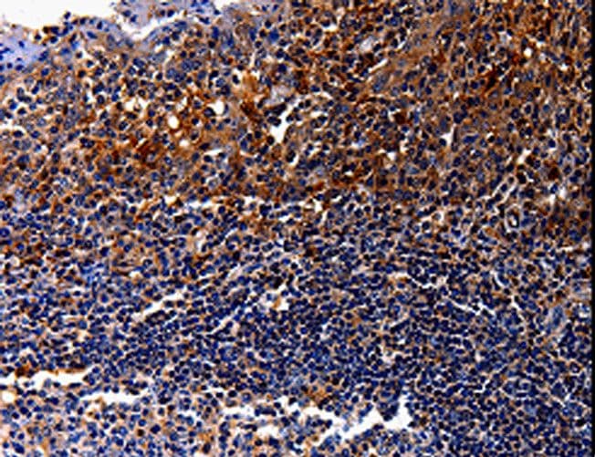 Polyclonal Rabbit anti-Human IL10RA Antibody (IHC)