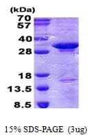 Human CD300C Protein (Recombinant His)