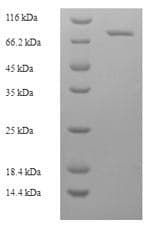 Crab-eating macaque ALB / Serum Albumin Protein (Recombinant DDK,C-terminus)