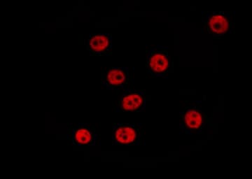 Polyclonal Rabbit anti-Human MAPK8 / JNK1 Antibody (phospho-Tyr185, IHC, IF, WB)