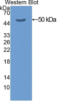 KRT20 / CK20 / Cytokeratin 20 Antibody (aa2-431)