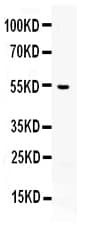 AEBP2 Antibody