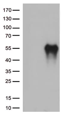 HAVCR2 / TIM-3 Antibody (clone OTI13A8)