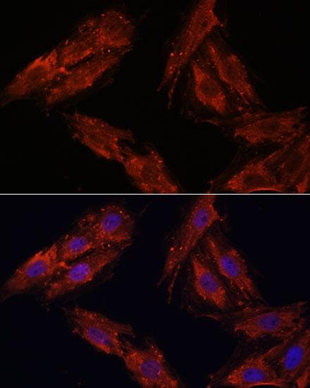 CDK6 Antibody