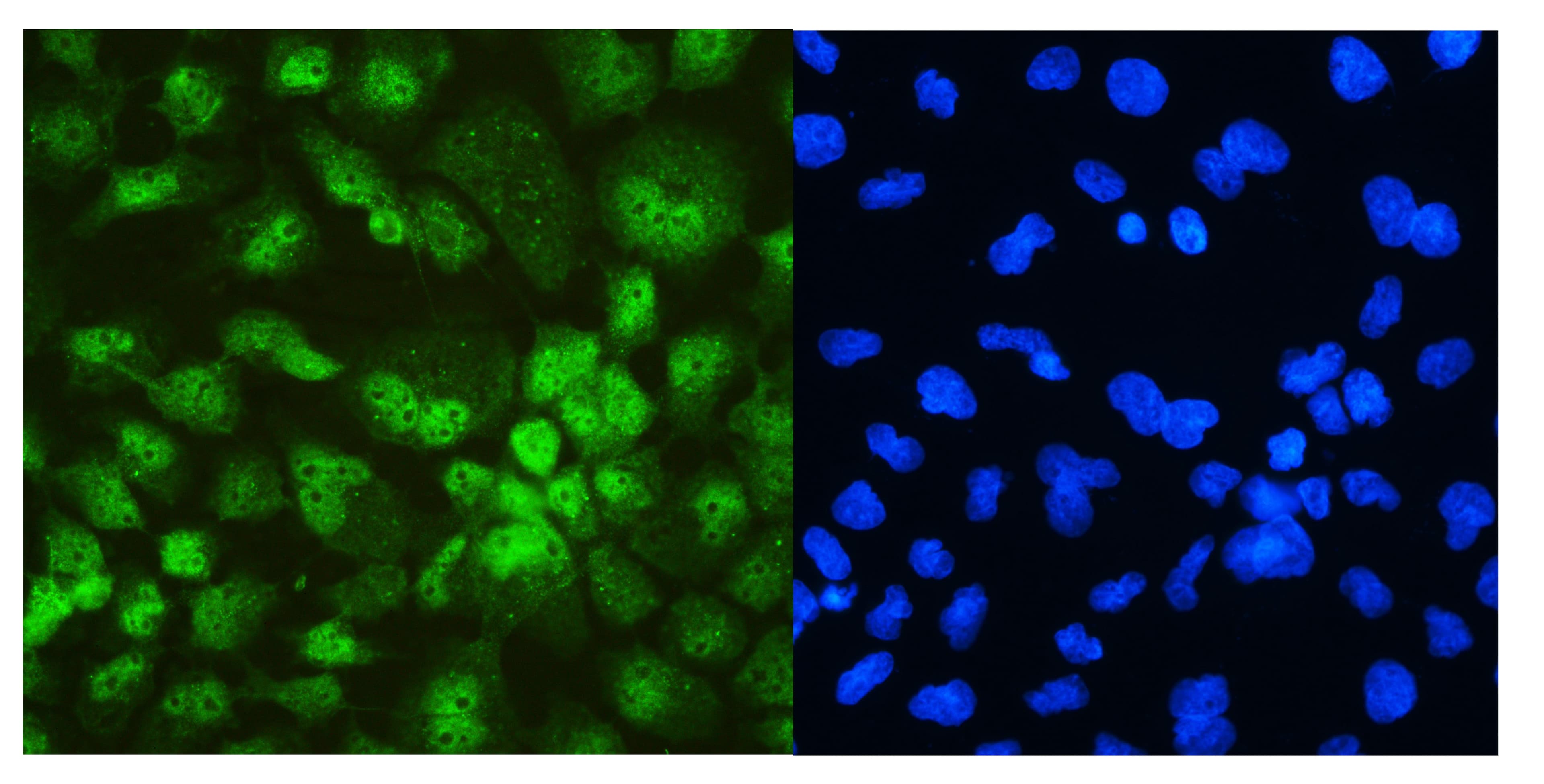 Polyclonal Rabbit anti-Human DDX5 Antibody (aa566-580, IHC, WB)