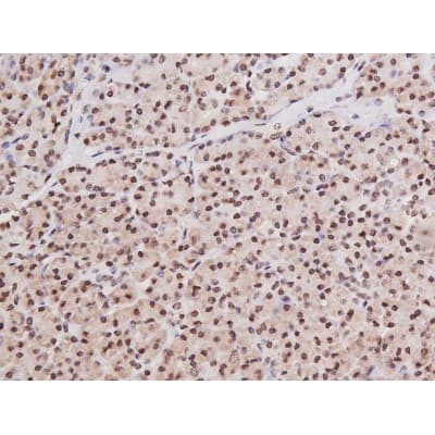 Polyclonal Rabbit anti-Human MAPT / Tau Antibody (phospho-Ser235, IHC, WB)