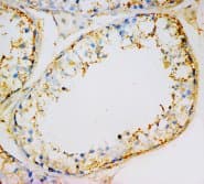 INSL3 Antibody (aa115-131)