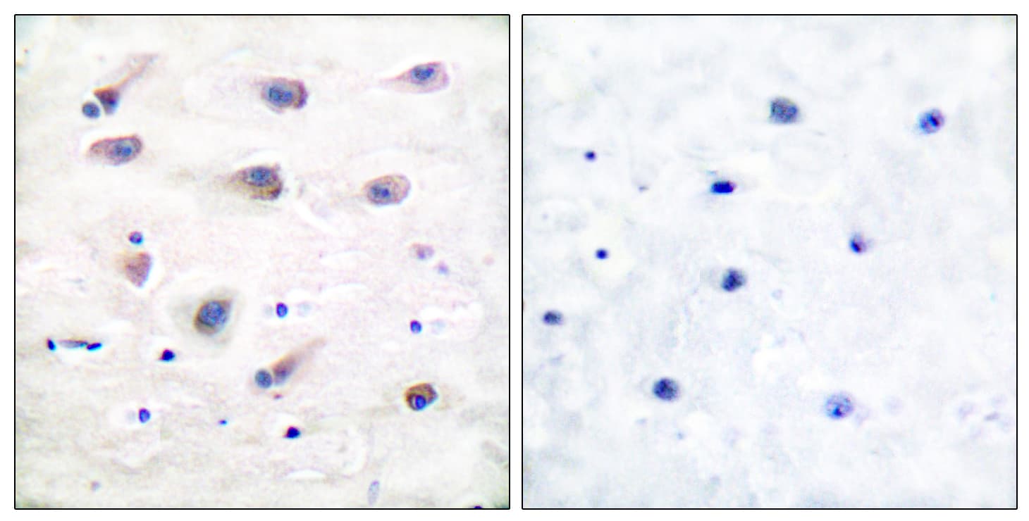Polyclonal Rabbit anti-Human PLCB3 Antibody (phospho-Ser1105, IHC, WB)