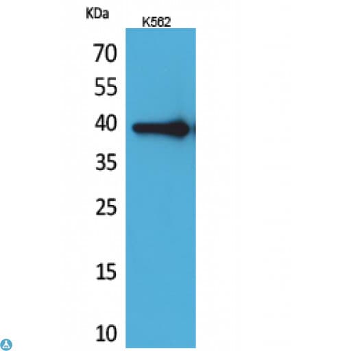 HSPA6 / HSP70B' Antibody