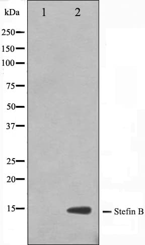CSTB / Cystatin B / Stefin B Antibody