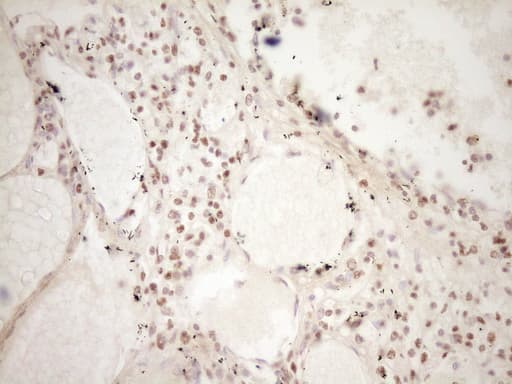 LPIN1 / Lipin 1 Antibody (clone OTI8F10)