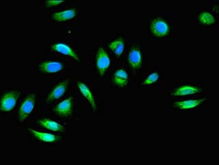 Polyclonal Rabbit anti-Human FHL2 Antibody (IHC, IF)