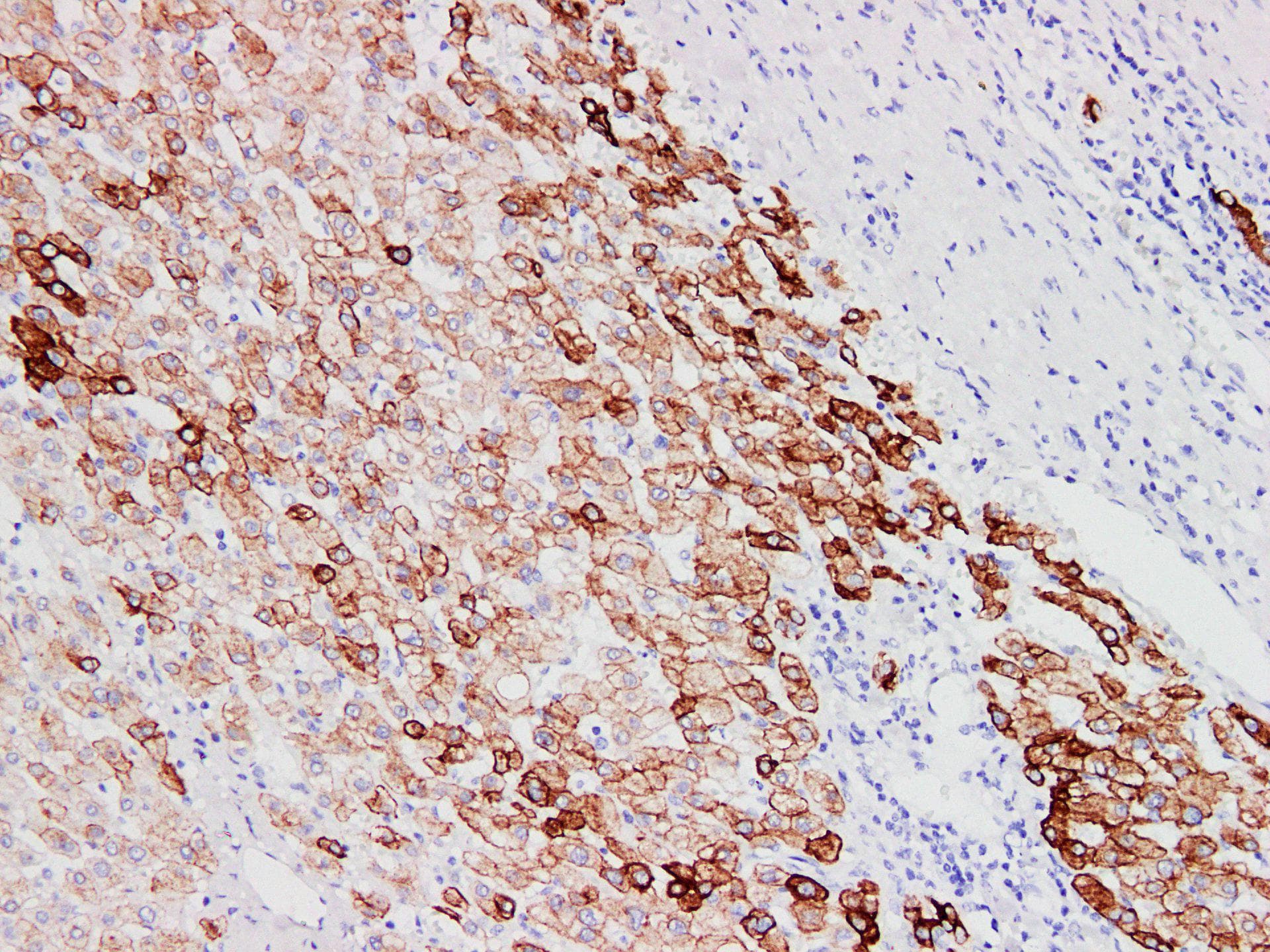 KRT18 / CK18 / Cytokeratin 18 Antibody
