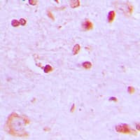 Polyclonal Rabbit anti-Human BRCA1 Antibody (Internal, IHC, WB)