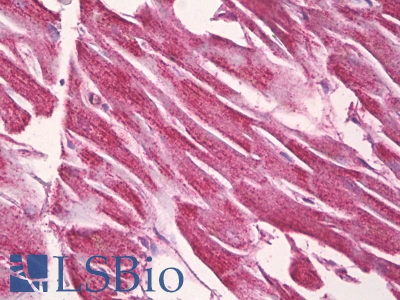 IHC-plus™ LAMB1 / Laminin Beta 1 Antibody (aa1721-1770)
