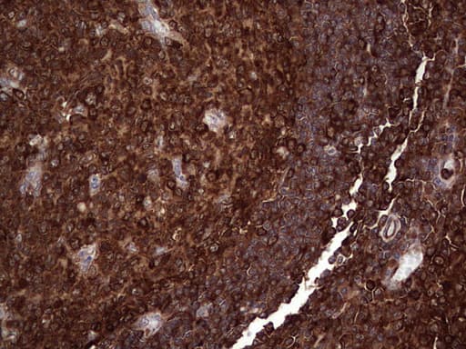 PKM2 Antibody (clone OTI12D5, Carrier-free)