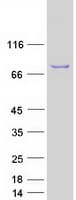 Human ENOX2 Protein (Recombinant Myc-DDK (Flag))