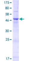 Human TMEM81 Protein (Recombinant GST)